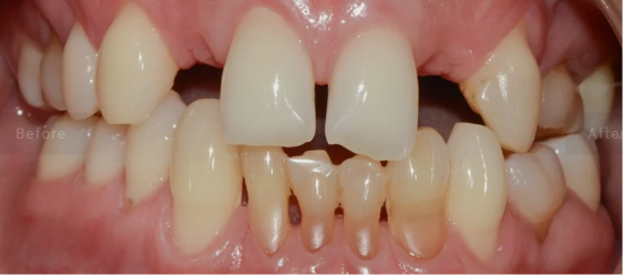 Smile rehabilitation before treatment